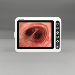 TigerScope Monitor 8" portátil para broncoscopio desechable