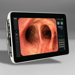 TigerScope Monitor 15,6" portátil para broncoscopio + adaptadores