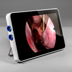 Ambu® aView™ 2 Advance Monitor portátil HD